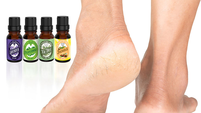 How to Make Essential Oil Roll-On Blend for Cracked Heels